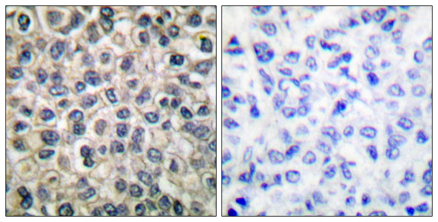 JUP/CTNNG/Junction Plakoglobin Antibody