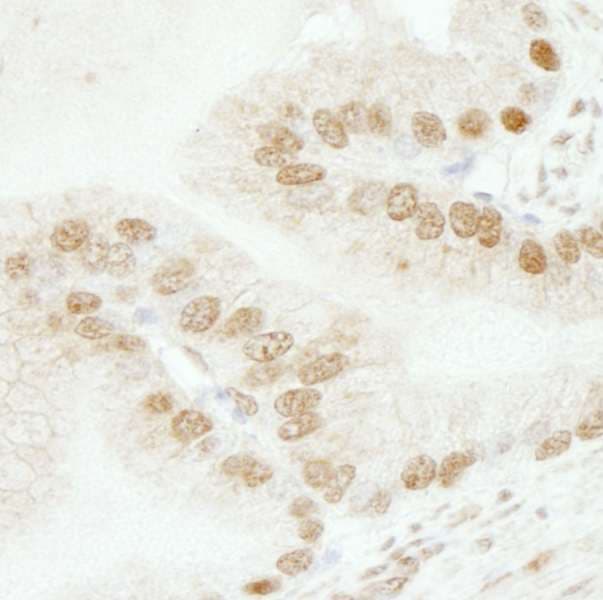 Polyclonal Rabbit anti-Human SMARCB1 / INI1 Antibody (aa75-125, IHC)