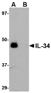 Polyclonal Rabbit anti-Human IL34 Antibody (WB)