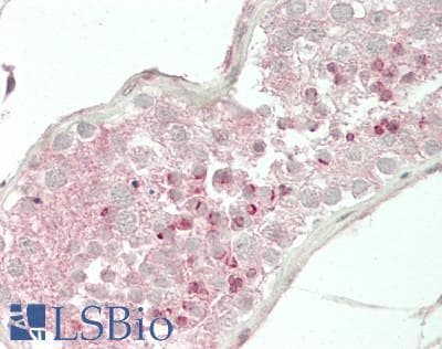 IHC-plus™ FAM20A Antibody