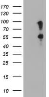 SPINT1 / HAI-1 Antibody (clone OTI1E2)