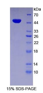 Human ENO2 / NSE Protein (Recombinant His)