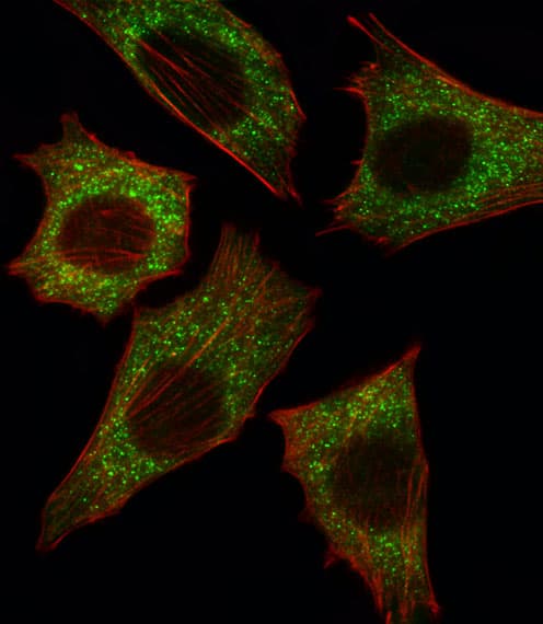 BRAF / B-Raf Antibody (aa424-453)