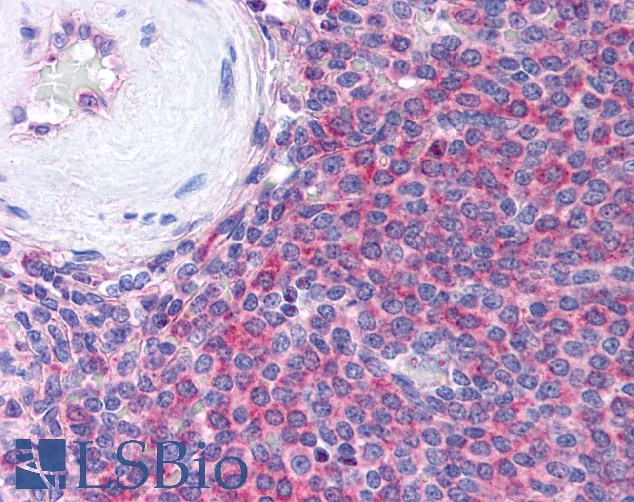 IHC-plus™ THBS1 / Thrombospondin-1 Antibody (Azide-free)
