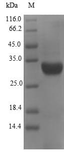 Escherichia coli fanC Protein (Recombinant 6His-SUMO, N-terminus)