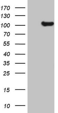 Monoclonal Mouse anti-Human KIAA1524 / p90 Autoantigen Antibody (clone OTI4F5, Carrier-free, aa635-905, WB)