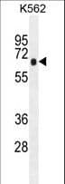 PRKAA1 / AMPK Alpha 1 Antibody