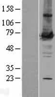 PRKCZ / PKC-Zeta Protein (Over-Expression Lysate Myc-DDK (Flag))
