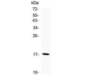 TNF Alpha Antibody