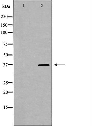 PSRC1 / DDA3 Antibody