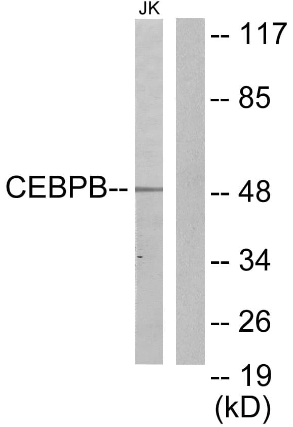 Polyclonal Rabbit anti-Human C/EBP Beta / CEBPB Antibody (aa231-280, WB)