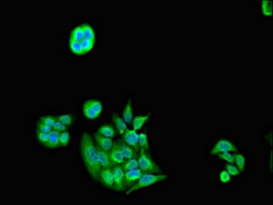 PSMC5 / SUG1 Antibody
