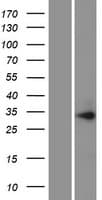 PIH1D1 Protein (Over-Expression Lysate Myc-DDK (Flag))