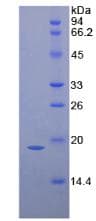 Human IL1RN Protein (Recombinant His, N-Terminal)