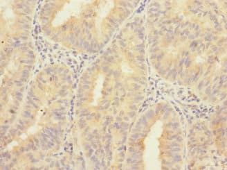 ZNF582 Antibody