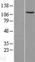 Human IDE Protein (Over-Expression Lysate Myc-DDK (Flag))