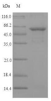 Chlamydia ompA Protein (Recombinant 6His-SUMO, N-terminus)