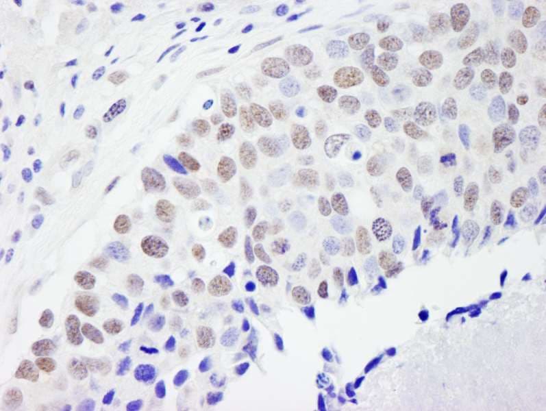 FLJ12529 / CPSF7 Antibody (aa175-225)
