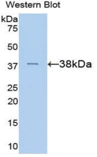 ANXA5 / Annexin V Antibody (aa1-320)
