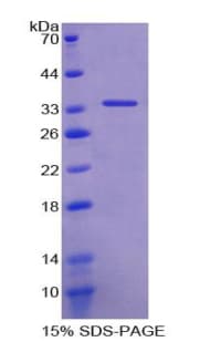 Mouse TCEB3 / Elongin A Protein (Recombinant His-T7)