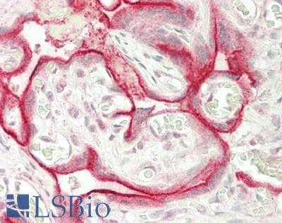IHC-plus™ Polyclonal Rabbit anti-Human CD71 / Transferrin Receptor Antibody (aa 94-754, IHC, IF, WB)