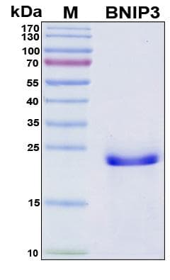 Human NIP3 / BNIP3 Protein (Recombinant His, N-Terminal)