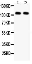 NFKB1 / NF-Kappa-B Antibody (aa193-208)