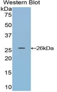 DDAH1 Antibody (aa20-215, PE)