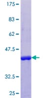 Human CRABP2 Protein (Recombinant GST)