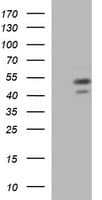 PARVB Antibody (clone OTI2B4)