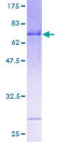 Human SERPINA12 / Vaspin Protein (Recombinant GST)