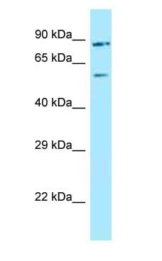 HUFI-2 / LRRFIP2 Antibody (aa585-634)