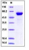 Human HMG1 / HMGB1 Protein (Recombinant Human IgG1 Fc, N-terminus)