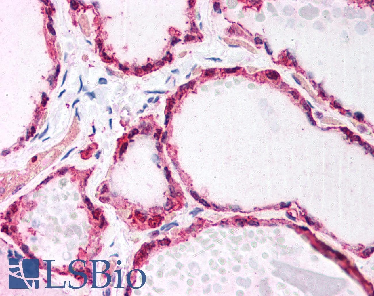 IHC-plus™ Monoclonal Mouse anti-Human GSTP1 / GST Pi Antibody (clone 3F2C2, IHC, IF, WB)