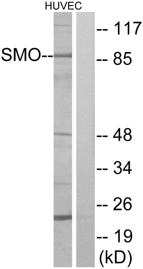 Polyclonal Rabbit anti-Human SMO / Smoothened Antibody (WB)