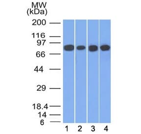 JUP/CTNNG/Junction Plakoglobin Antibody (clone 11E4., Azide-free, BSA-free)