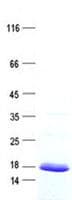Human CSAG3 Protein (Recombinant His, N-Terminal)