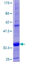 Human TFF1 / pS2 Protein (Recombinant GST)