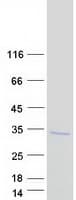 Human CTRB1 / Chymotrypsinogen B1 Protein (Recombinant Myc-DDK (Flag))