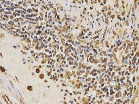 Polyclonal Rabbit anti-Human CDK4 Antibody (IHC, IF, WB)