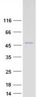Human CS / Citrate Synthase Protein (Recombinant Myc-DDK (Flag))