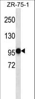 PHF14 Antibody (aa231-260)