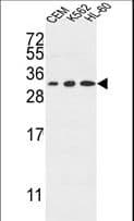 Polyclonal Rabbit anti-Human TSPAN2 Antibody (aa109-137, WB)