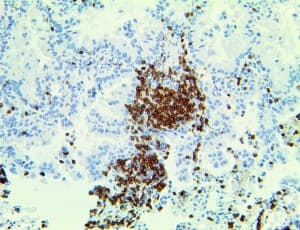 Monoclonal Mouse anti-Human TCR Alpha Antibody (Ready-to-Use, IHC)