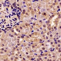 IHC-plus™ Polyclonal Rabbit anti-Human PNLIP / PL / Pancreatic Lipase Antibody (IHC, WB)