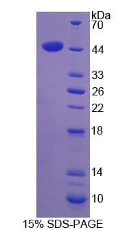 Human ACTG2 Protein (Recombinant His-T7)