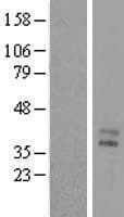 MENT / C1orf56 Protein (Over-Expression Lysate Myc-DDK (Flag))