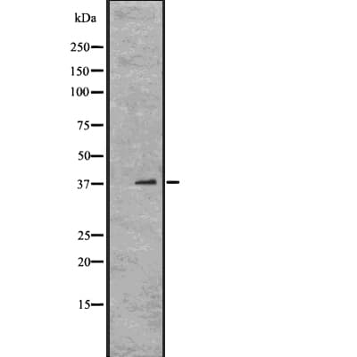 Polyclonal Rabbit anti-Human OTX1 Antibody (IF, WB)