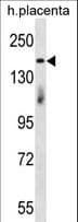 INT1 / INTS1 Antibody (aa113-142)