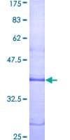 Human LPAR1 / LPA1 / EDG2 Protein (Recombinant GST, N-terminus)